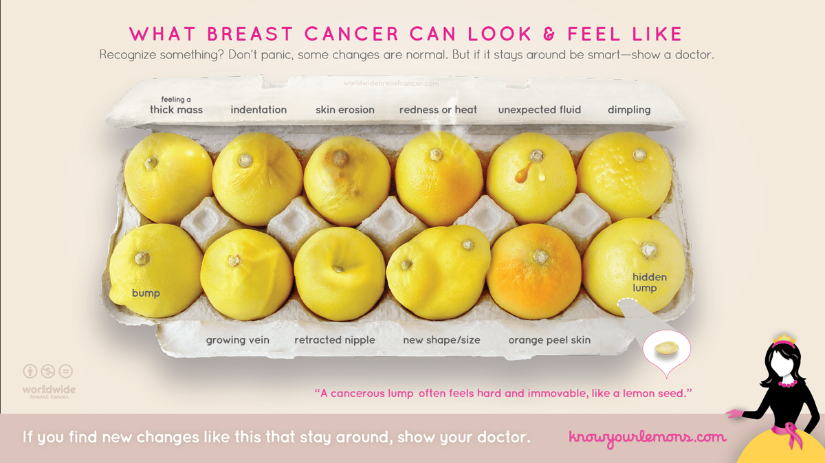 Cómo puede verse y sentirse el cáncer de mama